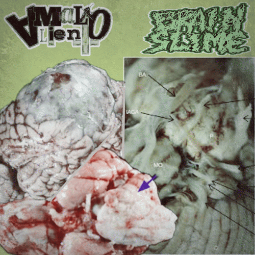 Mal Aliento : Mal Aliento - Brain Slime Mal Aliento : Mal Aliento - Brain Slime